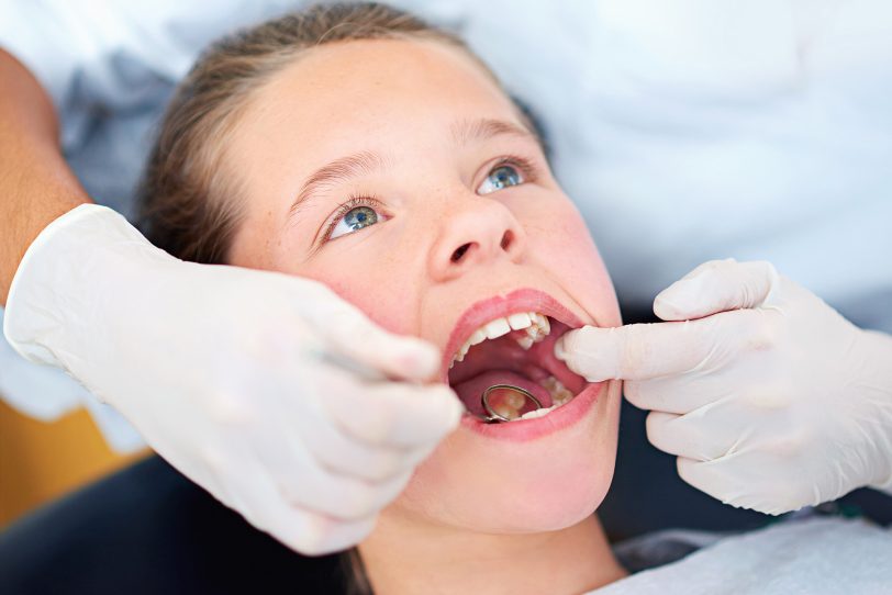 Die sorgfältige Zahnpflege und regelmäßige Kontrolle beim Zahnarzt ist ein unbedingtes Muss für die lebenslange Erhaltung der Mundgesundheit bei Kindern.