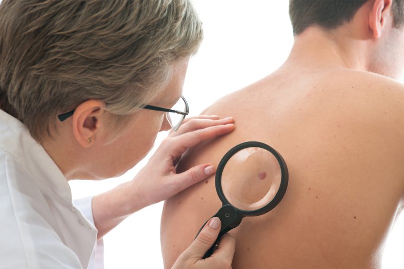 Wenn Krebs frühzeitig erkannt wird, bestehen gute Heilungschancen. Daher sollten Frauen und Männer in Herne die Chance der frühen Diagnostik nutzen.