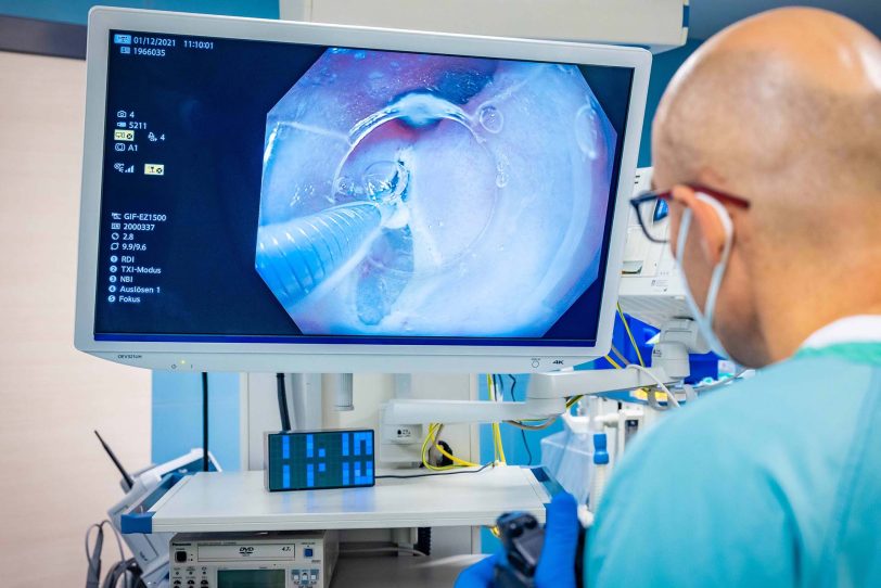 Dr. Viktor Rempel, Chefarzt der Klinik für Gastroenterologie des St. Anna Hospital während einer POEM: Mit gezielten Schnitten wird ein Tunnel bis zum Magen geschnitten.