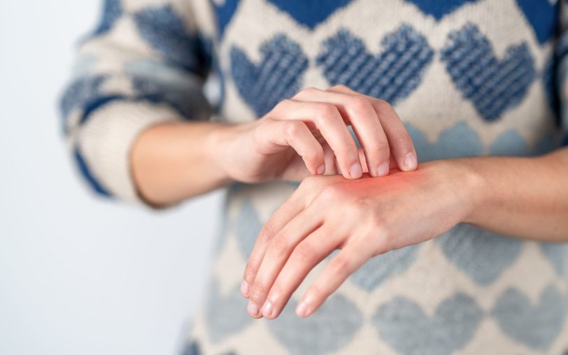 Trockene Heizungsluft verstärkt den Juckreiz bei Neurodermitis.